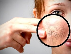 как ухаживать за кожей лица летом как ухаживать за кожей лица летом